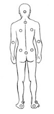 graphic of body showing common bed sore areas