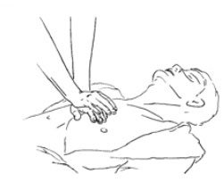 Example of CPR showing hands pressing on chest 15 times per 12 seconds