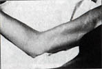 showing upper arm