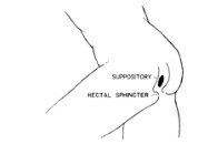 picture of suppository in rectal sphincter